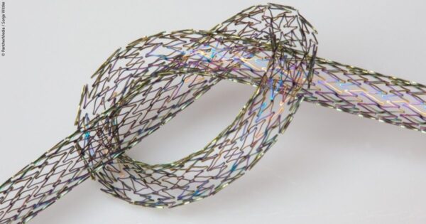 Nitinol