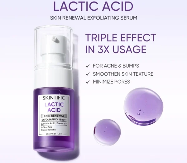 Lactic Acid
