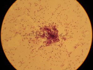 Lactic Acid Bacteria Culture — Lactobacillus plantarum